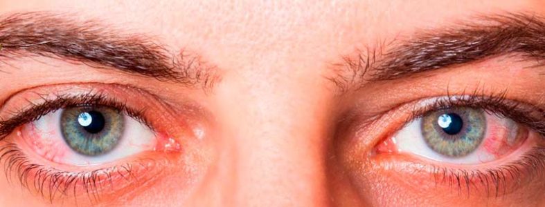 Como evitar la alergia ocular durante la primavera